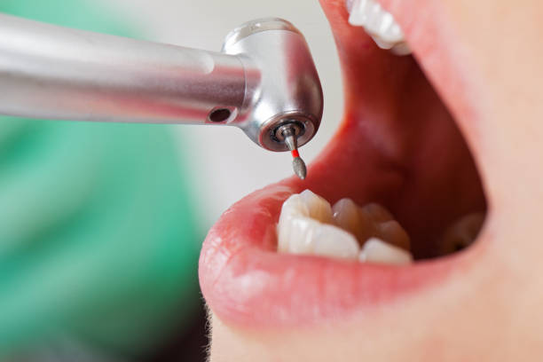 Best Pediatric Emergency Dentist in San Joaquin, CA